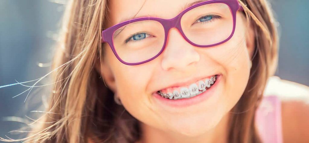 niña con brackets metálicos