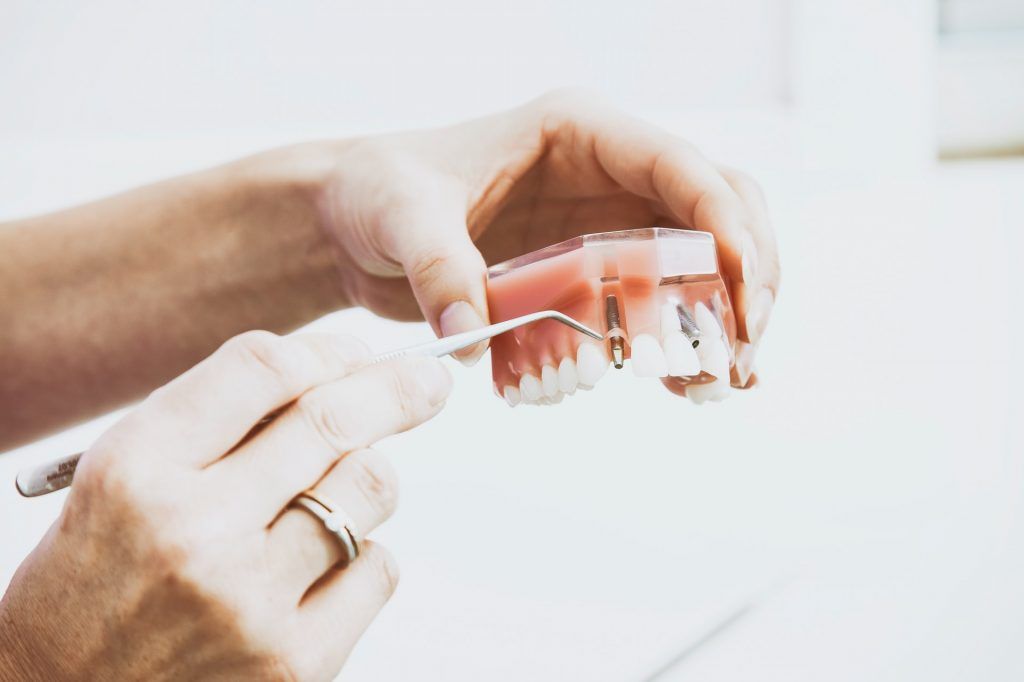 muestra de implante dental