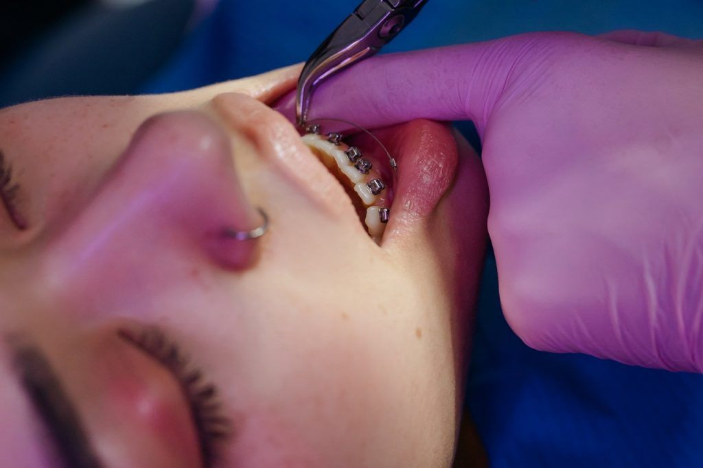 paciente ortodoncia en una revisión de brackets