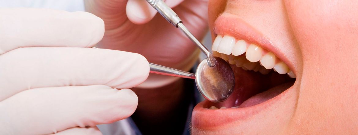 Quistectomía: qué es un quiste dental y cómo se quita