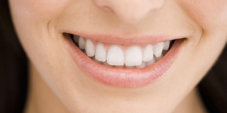 sonrisa